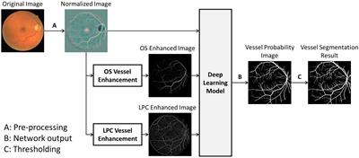 Improved fully convolutional neuron networks on small retinal vessel segmentation using local phase as attention